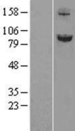 Novus Biologicals&trade;&nbsp;SLITRK6 Overexpression Lysate