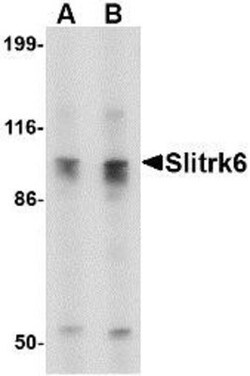 SLITRK6 Antibody - BSA Free, Novus Biologicals 0.025 mg, Unconjugated:Antibodies,