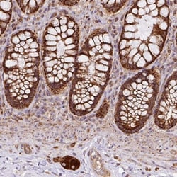 SLMO2 Antibody, Novus Biologicals 0.1mL; Unlabeled:Antibodies, Polyclonal