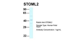 SLP-2 Antibody, Novus Biologicals 20μL; Unlabeled:Antibodies, Polyclonal