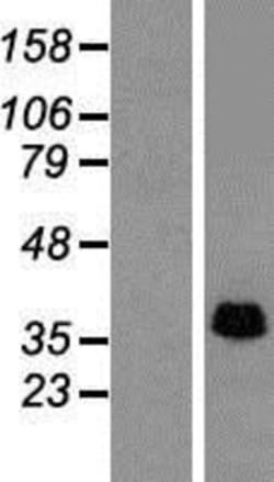 Novus Biologicals™ SLP-2 Overexpression Lysate
