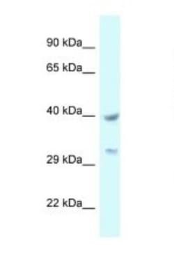 SLP-2 Antibody, Novus Biologicals 20μL; Unlabeled:Antibodies, Polyclonal