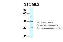 SLP-2 Antibody, Novus Biologicals 20μL; Unlabeled:Antibodies, Polyclonal