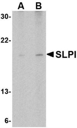 SLPI Antibody - BSA Free, Novus Biologicals 0.025 mg, Unconjugated:Antibodies,