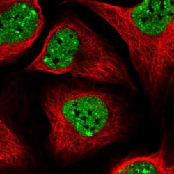 SLTM Antibody, Novus Biologicals 0.1mL; Unlabeled:Antibodies, Polyclonal