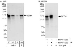 SLTM Antibody, Novus Biologicals 0.1mL; Unlabeled:Antibodies, Polyclonal