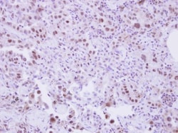 SLU7 Antibody, Novus Biologicals 0.1 mL | Buy Online | Novus Biologicals | Fisher Scientific