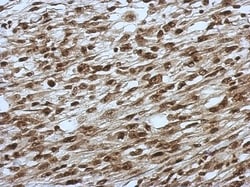 SLU7 Antibody, Novus Biologicals 0.1mL; Unlabeled:Antibodies, Polyclonal