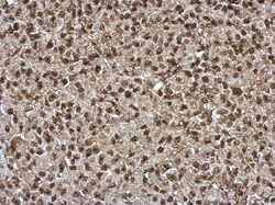SLU7 Antibody, Novus Biologicals 0.1mL; Unlabeled:Antibodies, Polyclonal
