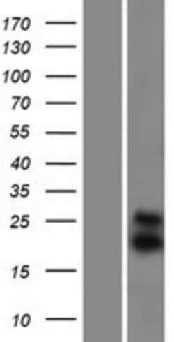 Novus Biologicals&trade;&nbsp;SMAC/Diablo Overexpression Lysate