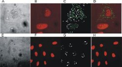 anti- SMAC/Diablo, Clone: 9H10, Novus Biologicals 0.05mg; Unlabeled:Antibodies,