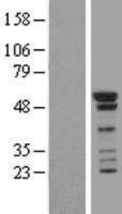 Novus Biologicals&trade;&nbsp;Smad1 Overexpression Lysate
