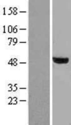 Novus Biologicals&trade;&nbsp;Smad2 Overexpression Lysate
