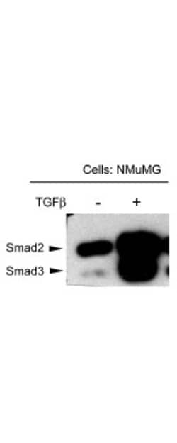 Smad3, p Thr179 Antibody, Novus Biologicals 0.1mg; Unlabeled:Antibodies,