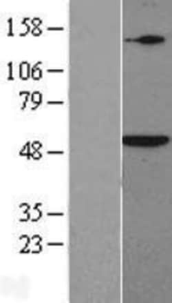 Novus Biologicals&trade;&nbsp;Smad5 Overexpression Lysate