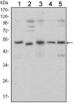 Smad5 Antibody (3H9), Novus Biologicals 0.1mL; Unlabeled:Antibodies, Monoclonal