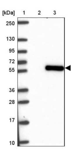 Smad5 Antibody, Novus Biologicals 0.1mL; Unlabeled:Antibodies, Polyclonal