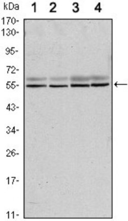 SMAD6 Antibody (5H3), Novus Biologicals 0.1mL; Unlabeled:Antibodies, Monoclonal