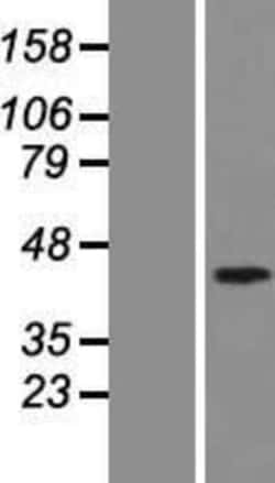 Novus Biologicals&trade;&nbsp;Smad7 Overexpression Lysate
