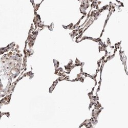 Smad7 Antibody, Novus Biologicals 0.1mL; Unlabeled:Antibodies, Polyclonal