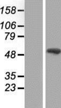 Novus Biologicals&trade;&nbsp;Smad9 Overexpression Lysate