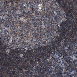 SMAP2 Antibody, Novus Biologicals:Antibodies:Primary Antibodies