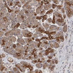 SMAP2 Antibody, Novus Biologicals:Antibodies:Primary Antibodies