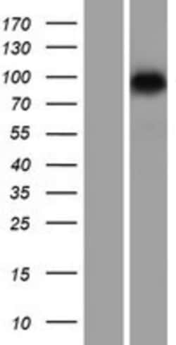 Novus Biologicals&trade;&nbsp;SMARCA6 Overexpression Lysate