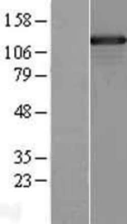 Novus Biologicals™ SMARCAD1 Overexpression Lysate