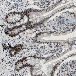 SMARCAD1 Antibody, Novus Biologicals 0.1mL; Unlabeled:Antibodies, Polyclonal