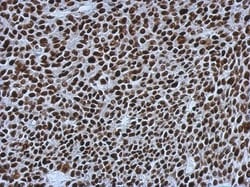 SMARCC1 Antibody, Novus Biologicals 0.1mL; Unlabeled:Antibodies, Polyclonal