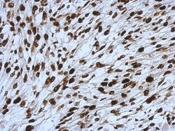 SMARCC1 Antibody, Novus Biologicals 0.1mL; Unlabeled:Antibodies, Polyclonal