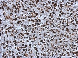 SMARCC1 Antibody, Novus Biologicals 0.1mL; Unlabeled:Antibodies, Polyclonal