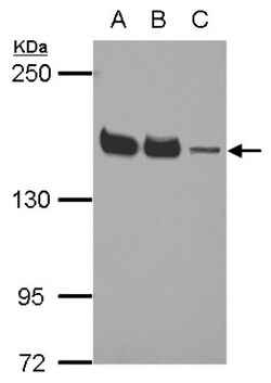 SMARCC1 Antibody, Novus Biologicals 0.1mL; Unlabeled:Antibodies, Polyclonal