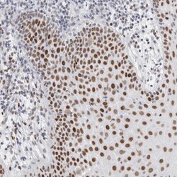 SMARCC1 Antibody, Novus Biologicals 25 &mu;L; Unlabeled:Antibodies, Polyclonal