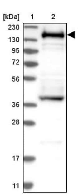 SMARCC1 Antibody, Novus Biologicals 25 &mu;L; Unlabeled:Antibodies, Polyclonal