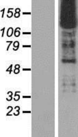Novus Biologicals&trade;&nbsp;SMARCC2/BAF170 Overexpression Lysate