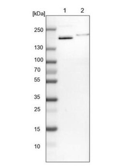 SMARCC2/BAF170 Antibody, Novus Biologicals:Antibodies:Primary Antibodies