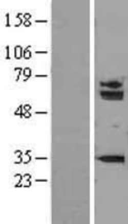 Novus Biologicals™ SMARCD1 Overexpression Lysate