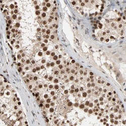 SMARCD1 Antibody, Novus Biologicals:Antibodies:Primary Antibodies