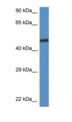 SMARCD3 Antibody, Novus Biologicals 100&mu;L; Unlabeled:Antibodies, Polyclonal