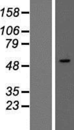 Novus Biologicals&trade;&nbsp;SMARCD3 Overexpression Lysate
