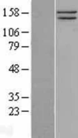 Novus Biologicals&trade;&nbsp;SMC1 Overexpression Lysate
