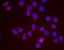 SMC1, p Ser957 Antibody, Novus Biologicals 0.1mL; Unlabeled:Antibodies,