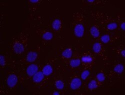 SMC1, p Ser957 Antibody, Novus Biologicals 0.1mL; Unlabeled:Antibodies,