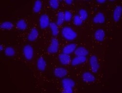 SMC1, p Ser957 Antibody, Novus Biologicals 0.1mL; Unlabeled:Antibodies,
