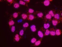 SMC1, p Ser966 Antibody, Novus Biologicals 0.1mL; Unlabeled:Antibodies,