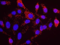 SMC1, p Ser966 Antibody, Novus Biologicals 0.1mL; Unlabeled:Antibodies,