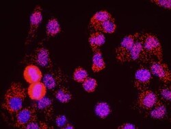 SMC1, p Ser966 Antibody, Novus Biologicals 0.1mL; Unlabeled:Antibodies,