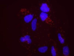 SMC1, p Ser966 Antibody, Novus Biologicals 0.1mL; Unlabeled:Antibodies,